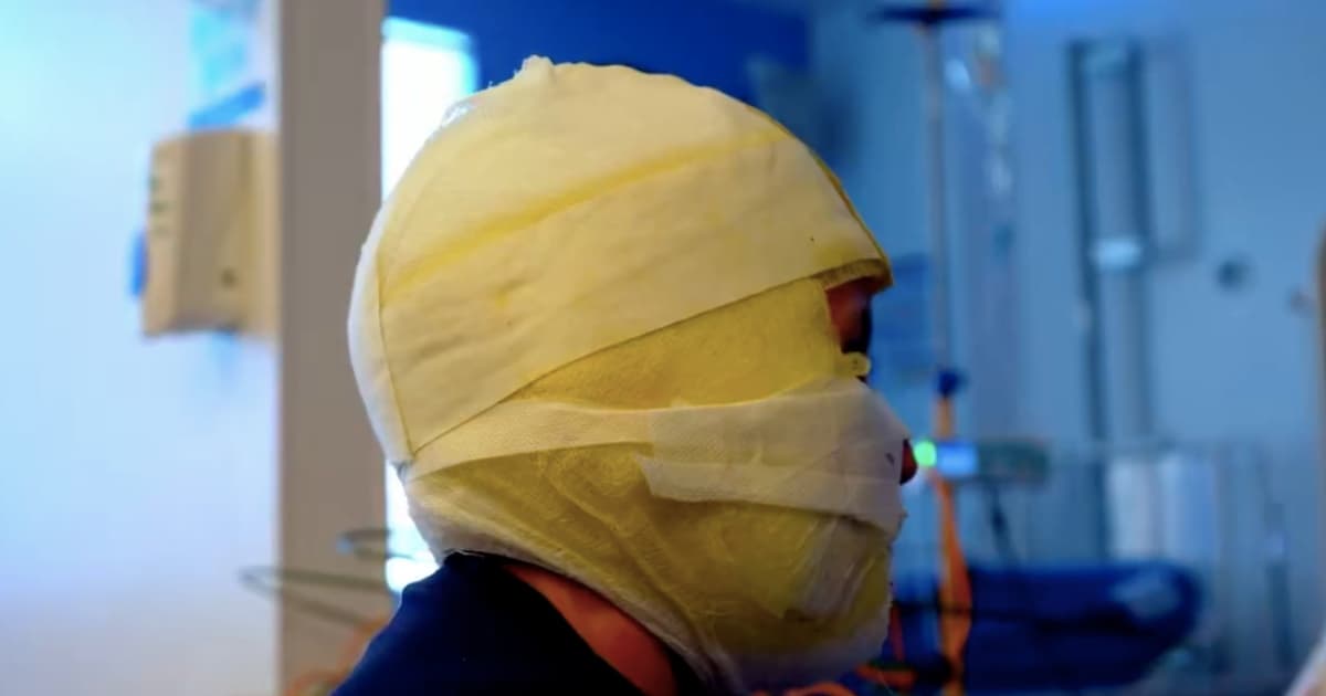 Foto de un menor de edad víctima de quemaduras con pólvora en Bogotá.