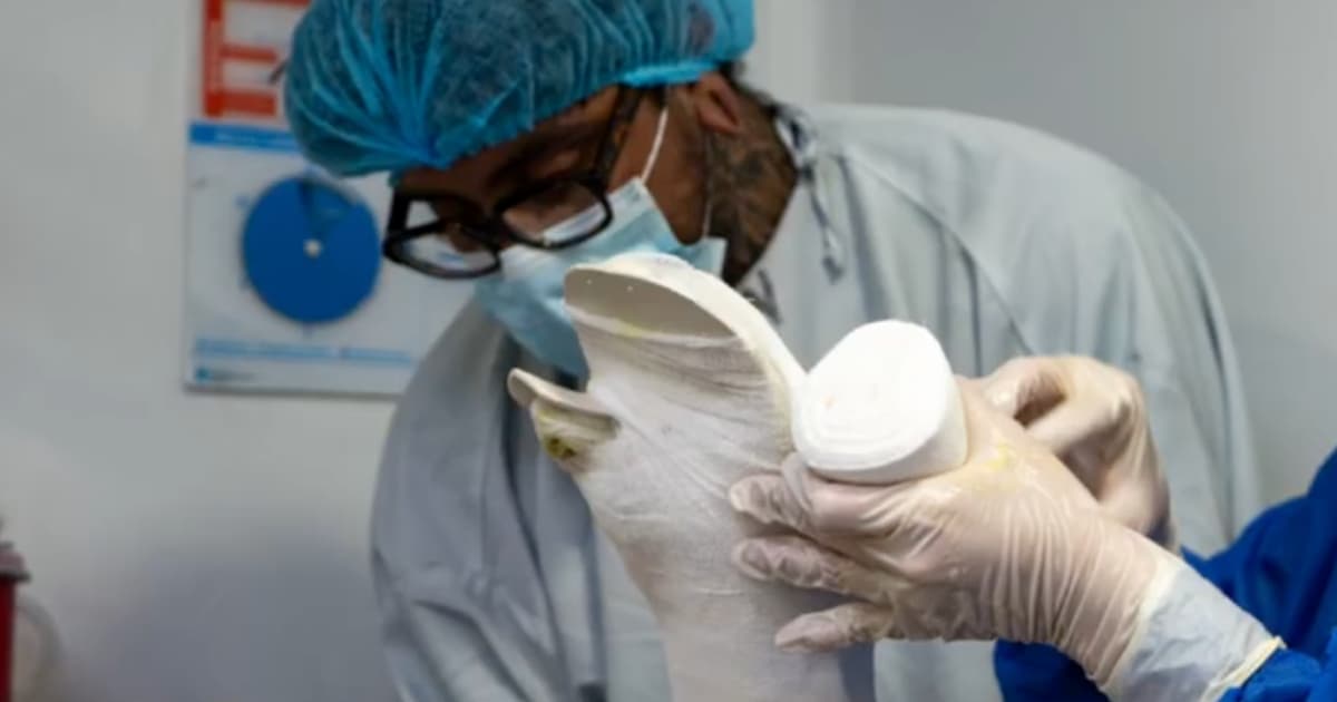 Van 54 personas lesionadas con pólvora en Bogotá 22 de diciembre 2025