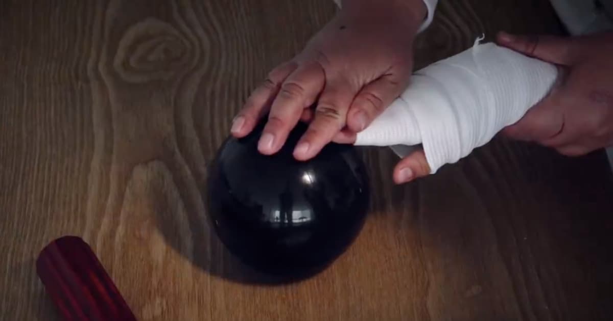 Foto de un menor de edad víctima de quemaduras con pólvora en Bogotá.