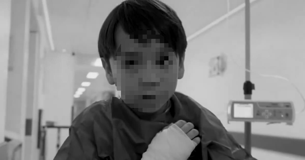 Imagen de un niños con una venda en la mano por quemadura