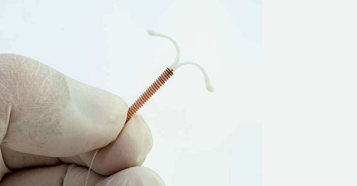 Foto de una T de cobre, método anticonceptivo
