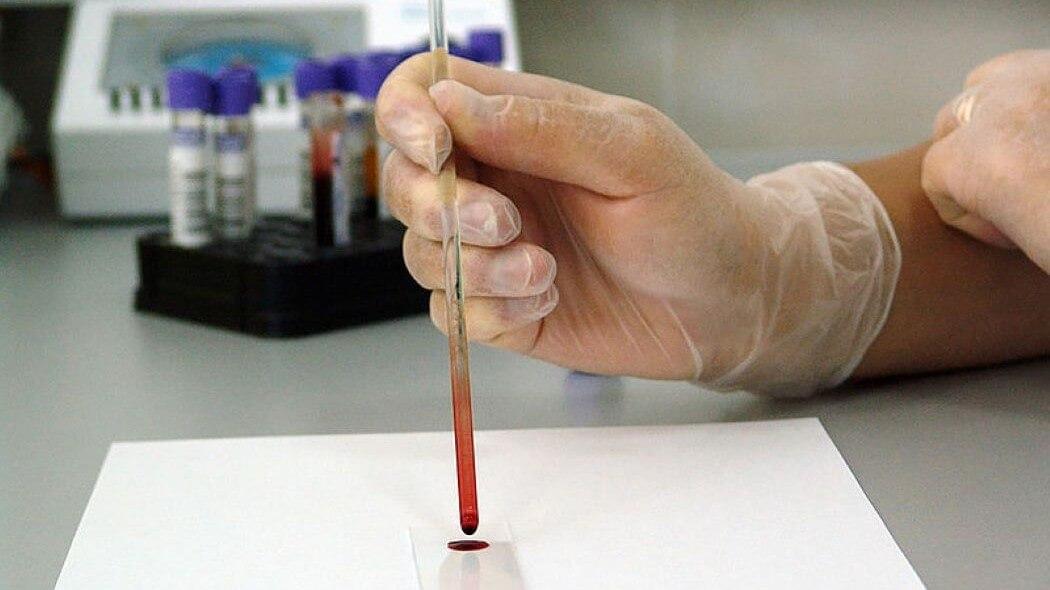 Imagen de una prueba de laboratorio en la U Nacional