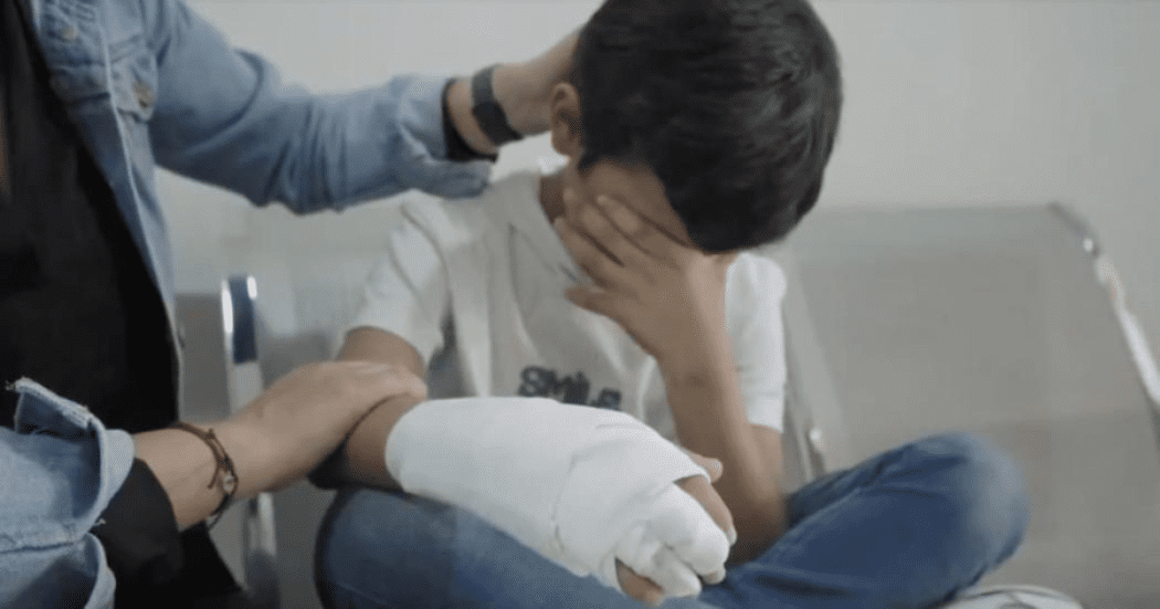 Foto de un niño con quemaduras en la mano