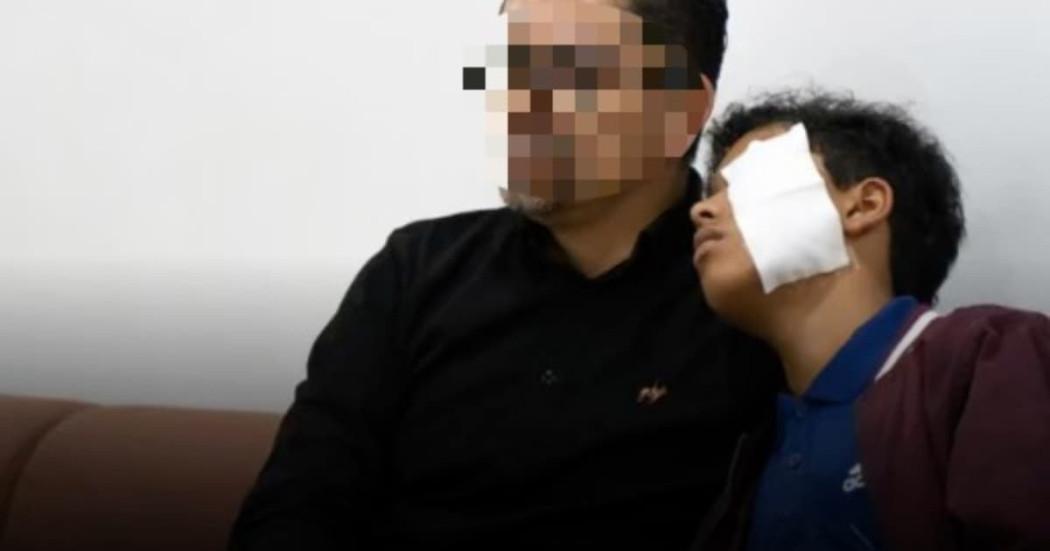 Foto de un menor de edad víctima de quemaduras con pólvora en Bogotá, junto a su padre.