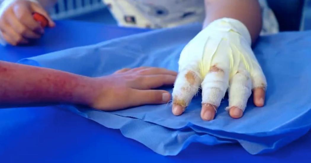 Foto de personas lesionadas con pólvora en Bogotá.