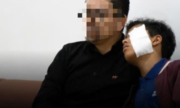 Foto de un menor de edad víctima de quemaduras con pólvora en Bogotá, junto a su padre.