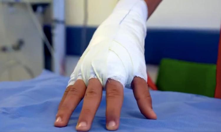 Foto de un menor de edad víctima de quemaduras con pólvora en Bogotá.