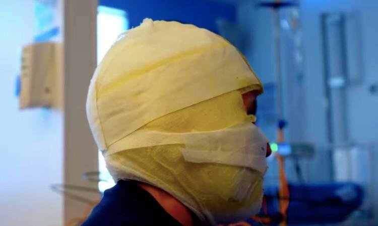 Imagen de una persona con el rostro vendado