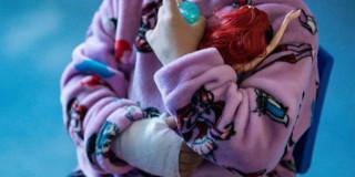 Foto de un niño lesionado com pólvora en un hospital de Bogotá.