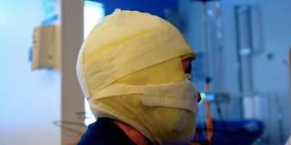 Imagen de una cabeza vendada por quemadura con pólvora