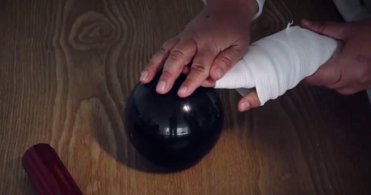 Foto de un menor de edad víctima de quemaduras con pólvora en Bogotá.